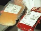 Проект "Чистая кровь". Риск заражения гепатитом снизился.  Нужна помощь на покупку реактивов.
